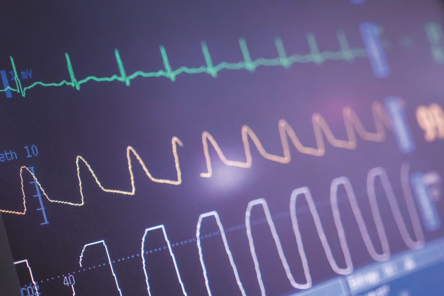 ECG LCD Screen monitor. Medical concept. Patient monitor displays vital signs ECG electrocardiogram EKG, oxygen saturation SPO2 and respiration.