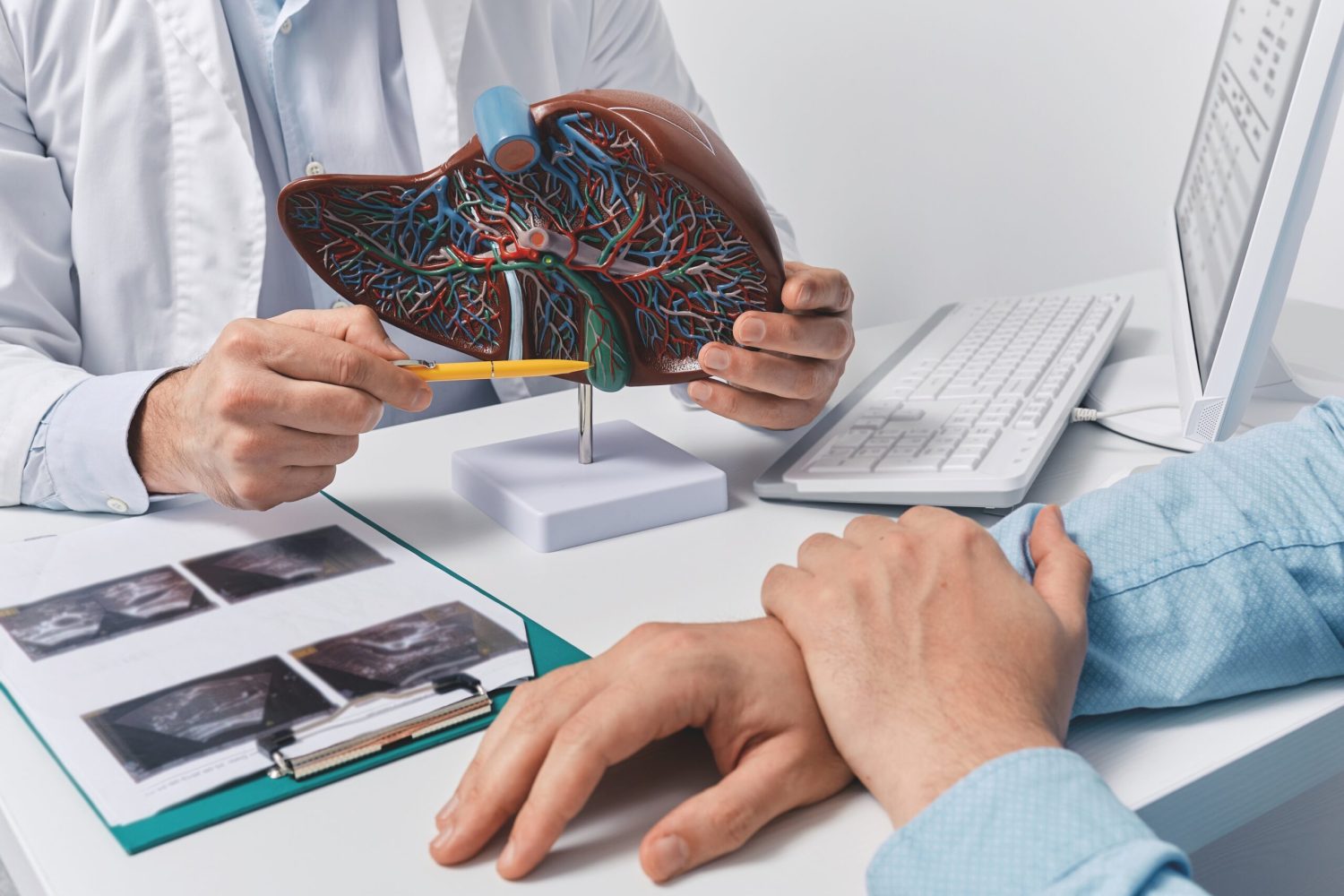 Human liver model on doctor's table, close-up. Treatment of hepatitis, cirrhosis and liver cancer